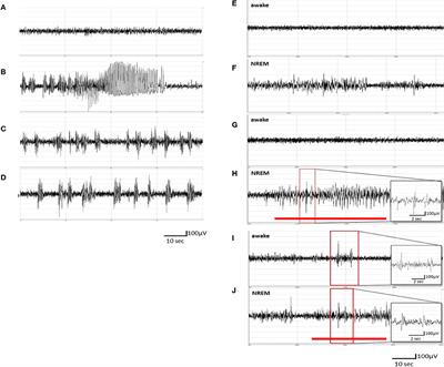 Deep Brain Stimulation Increases Seizure Threshold by Altering REM Sleep and Delta Powers During NREM Sleep